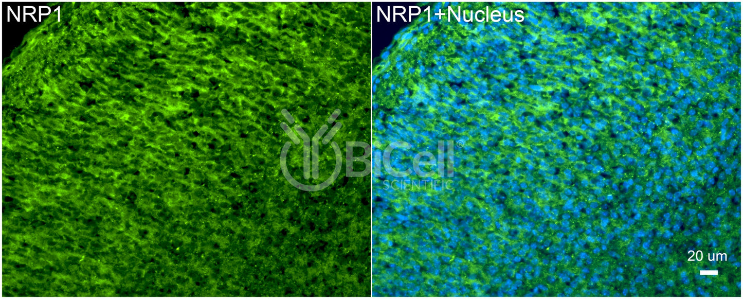 Neuropilin-1 (NRP1) Antibody - FFPE Validated