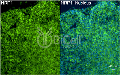 Neuropilin-1 (NRP1) Antibody - FFPE Validated