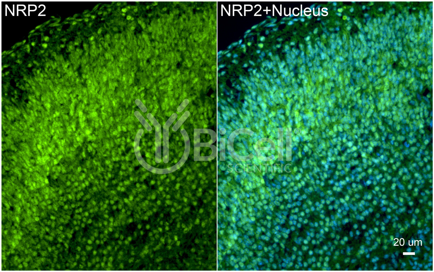 Neuropilin-2 (NRP2) Antibody - Western Blot Validated