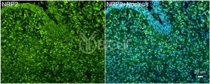Neuropilin-2 (NRP2) Antibody - Western Blot Validated
