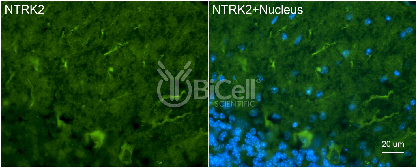 Trk-B (NTRK2) (N-Terminus) (Extracellular) Antibody