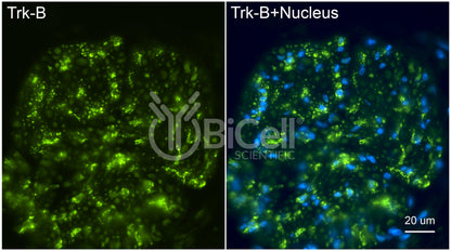 Trk-B (NTRK2) (C-Terminus) (Cytoplasmic) Antibody