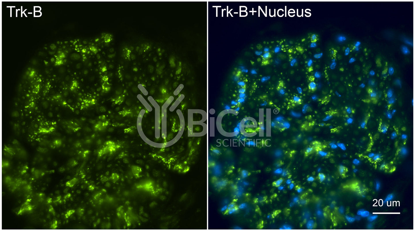 Trk-B (NTRK2) (C-Terminus) (Cytoplasmic) Antibody - FFPE Validated