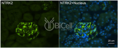 Trk-B (NTRK2) (N-Terminus) (Extracellular) Antibody - FFPE Validated