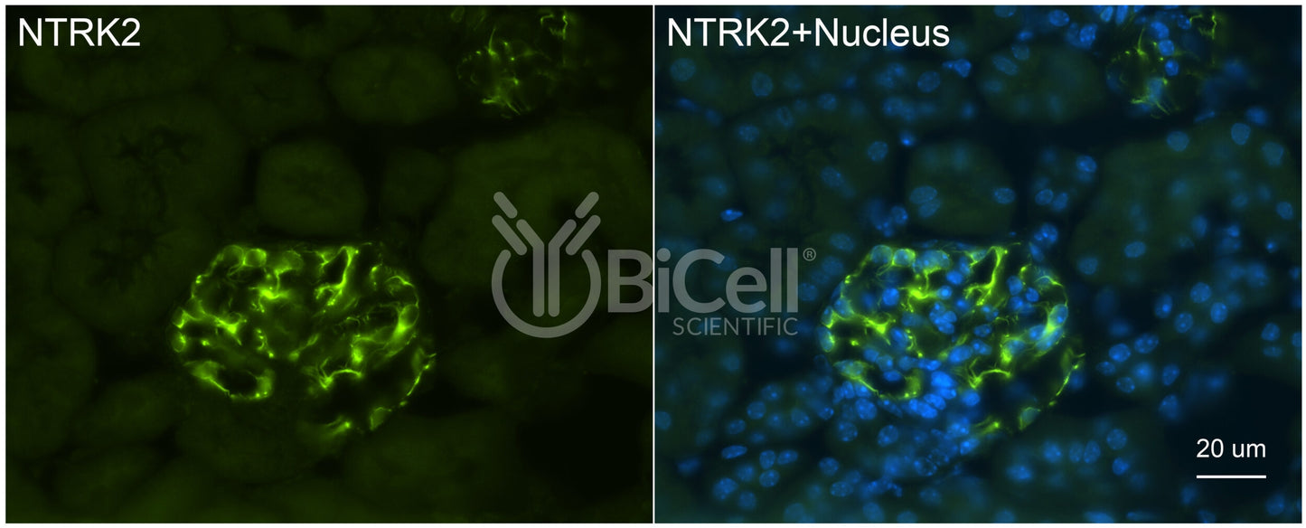 Trk-B (NTRK2) (N-Terminus) (Extracellular) Antibody