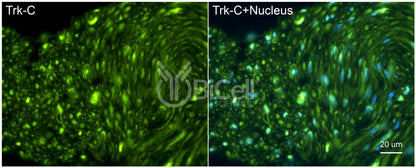 Trk-C (NTRK3) Antibody - FFPE Validated