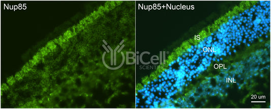 Nucleoporin-85 (Nup85 or PCNT1) Antibody - FFPE Validated