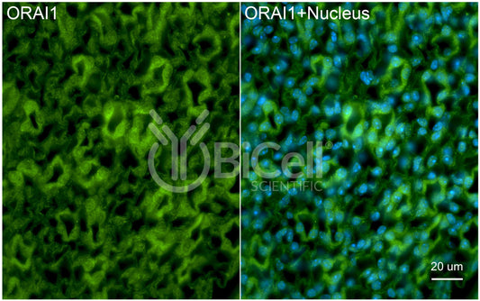 ORAI1 (TAM2 or TMEM142A) Antibody - Western Blot Validated