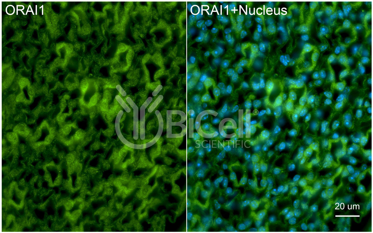 ORAI1 (TAM2 or TMEM142A) Antibody - FFPE Validated