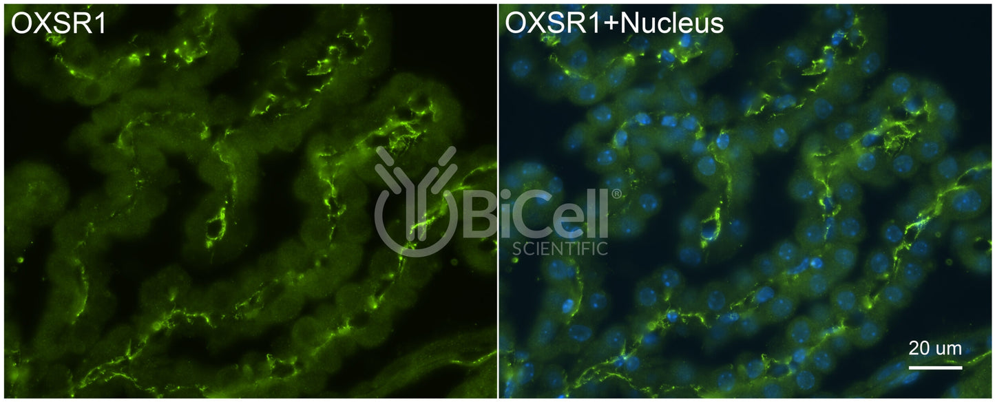 OXSR1 (OSR1) Antibody