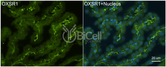 OXSR1 (OSR1) Antibody