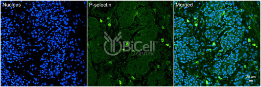 P-selectin (SELP or LECAM3 or CD62P) Antibody - Western Blot Validated