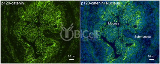 p120-catenin (Ctnnd1) Antibody - Western Blot Validated