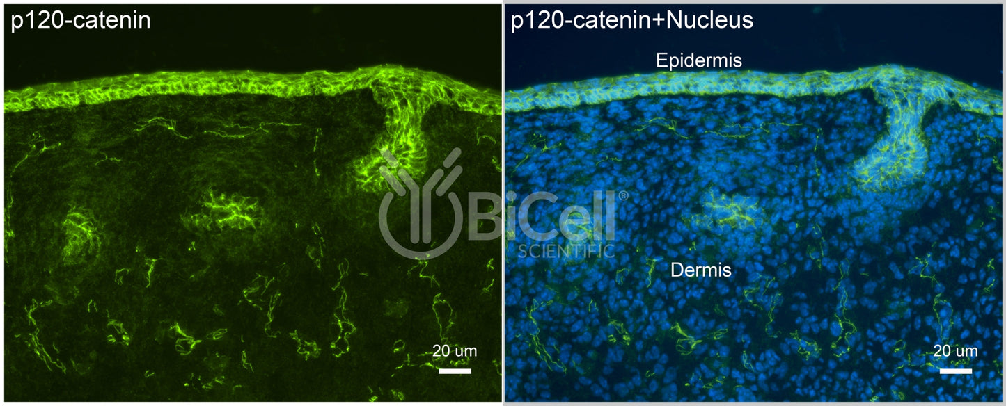 p120-catenin (Ctnnd1) Antibody
