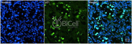 CDKN1A (P21 or P21CIP1 or CIP1) Antibody - Western Blot Validated