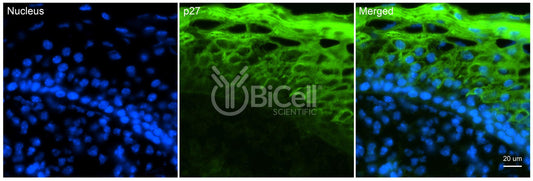 CDKN1B (P27 or P27KIP1 or KIP1) Antibody