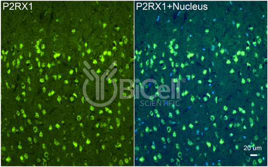 P2RX1 (P2X1) Antibody - Western Blot Validated