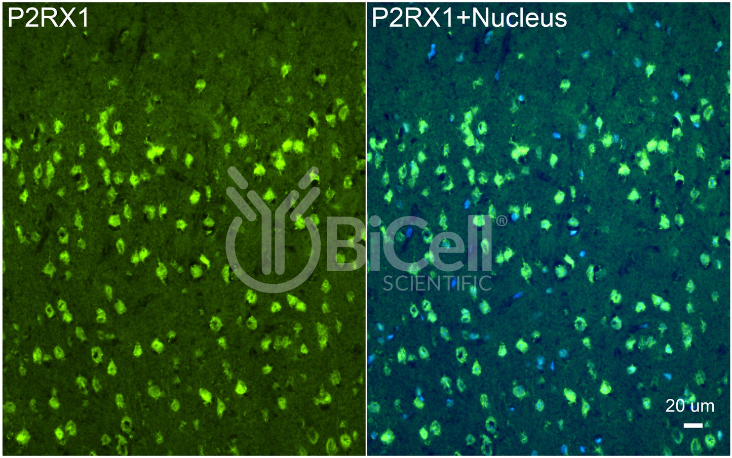 P2RX1 (P2X1) Antibody
