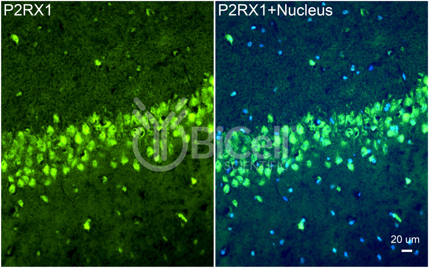 P2RX1 (P2X1) Antibody