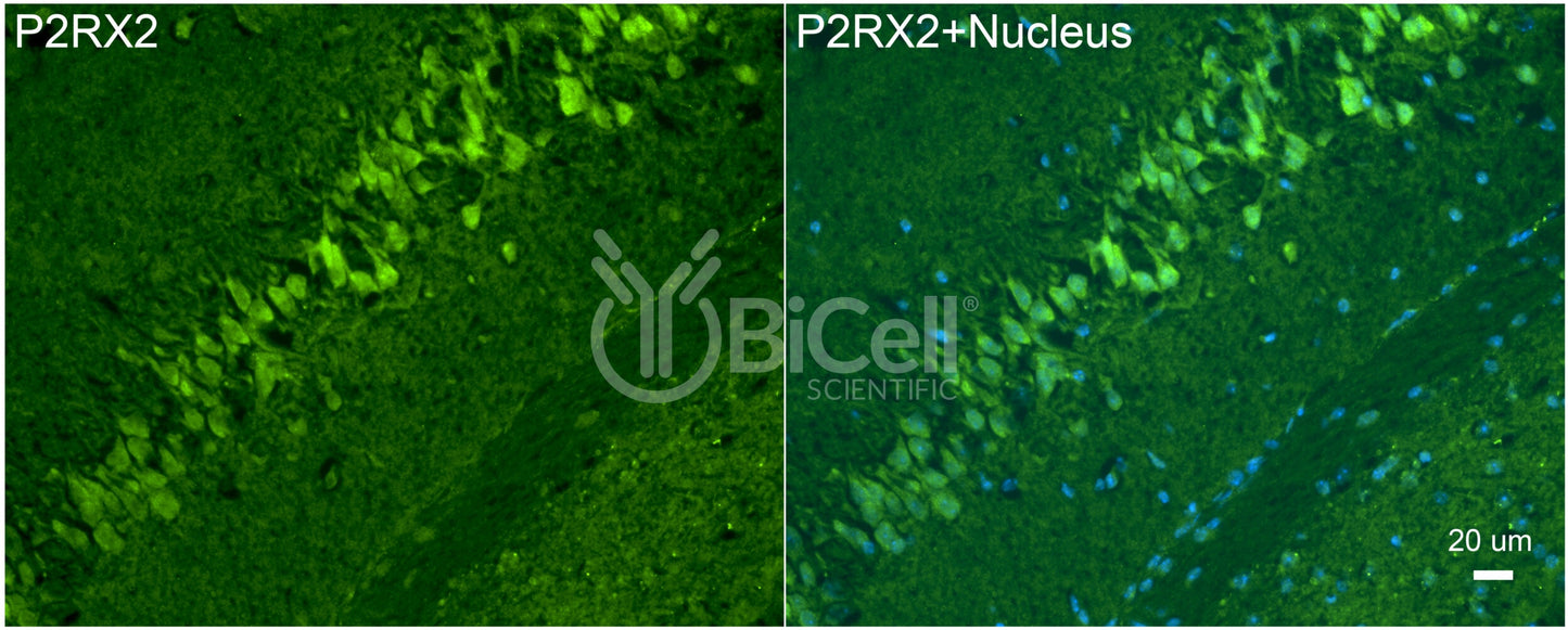 P2RX2 (P2X2) Antibody - FFPE Validated