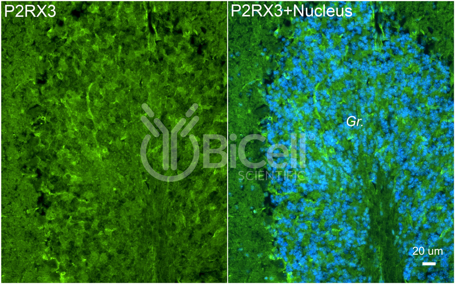 P2RX3 (P2X3) Antibody