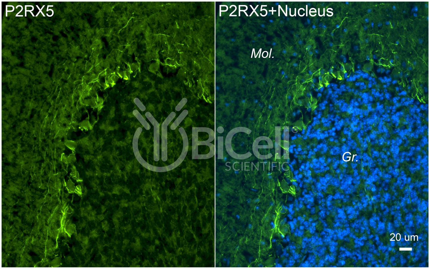 P2RX5 (P2X5) Antibody - FFPE Validated
