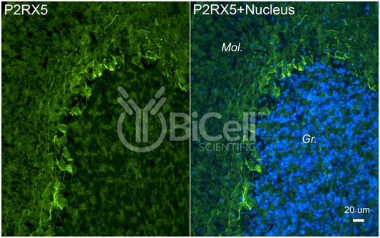 P2RX5 (P2X5) Antibody