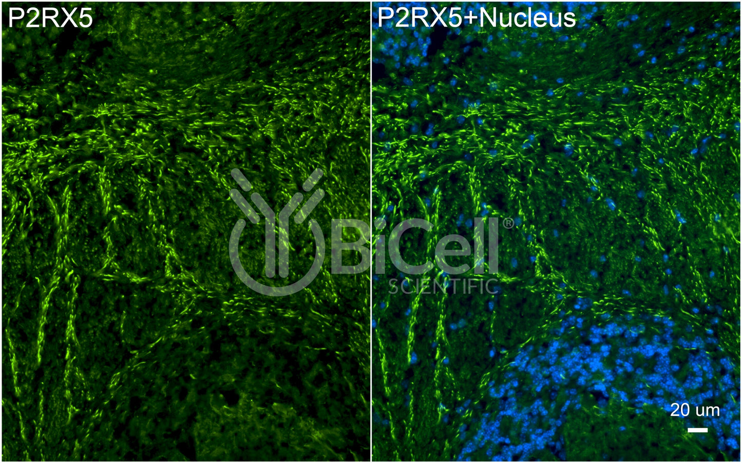P2RX5 (P2X5) Antibody - Western Blot Validated