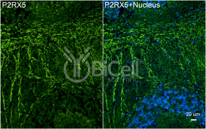 P2RX5 (P2X5) Antibody