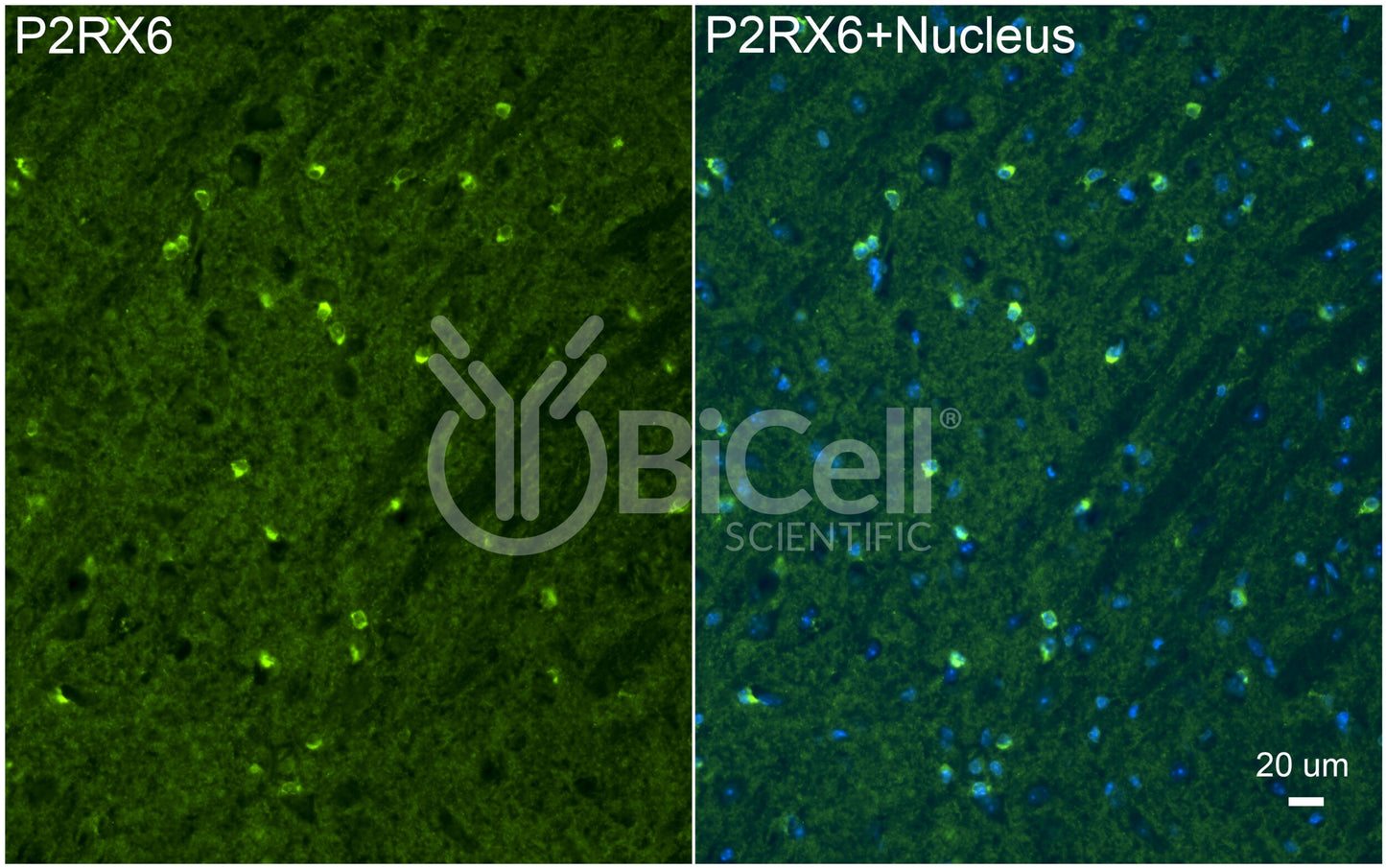 P2RX6 (P2X6) Antibody - FFPE Validated