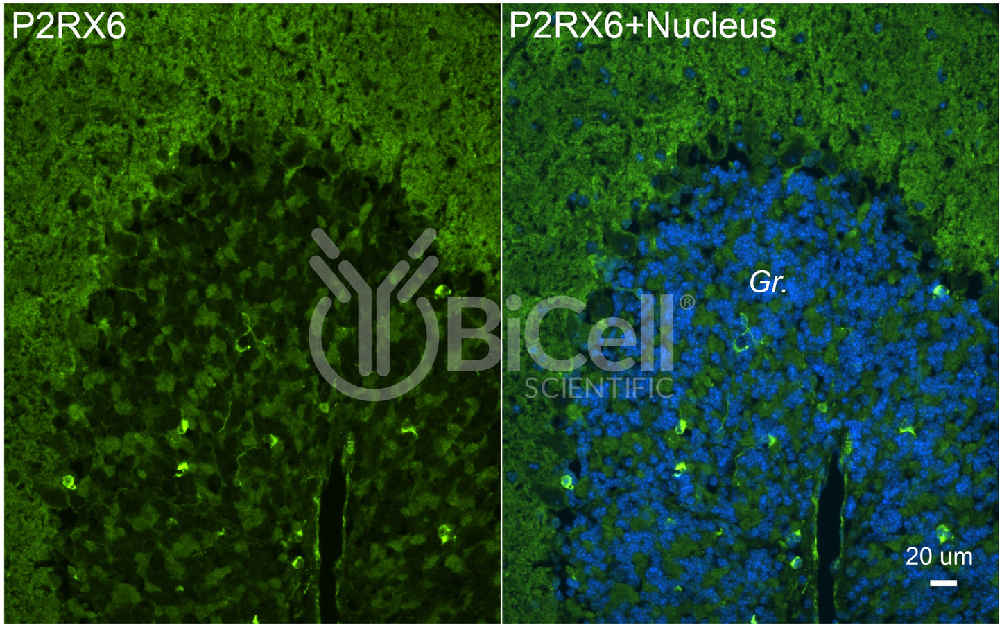 P2RX6 (P2X6) Antibody - Western Blot Validated