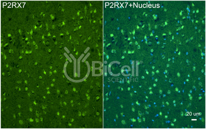 P2RX7 (P2X7) Antibody - FFPE Validated