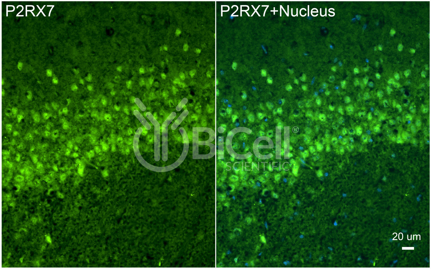 P2RX7 (P2X7) Antibody - FFPE Validated
