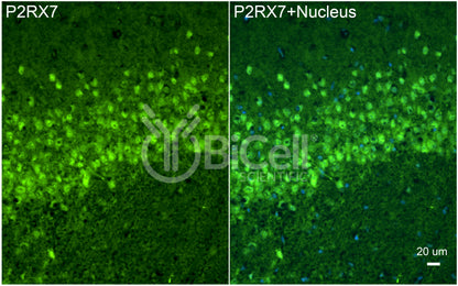 P2RX7 (P2X7) Antibody - FFPE Validated