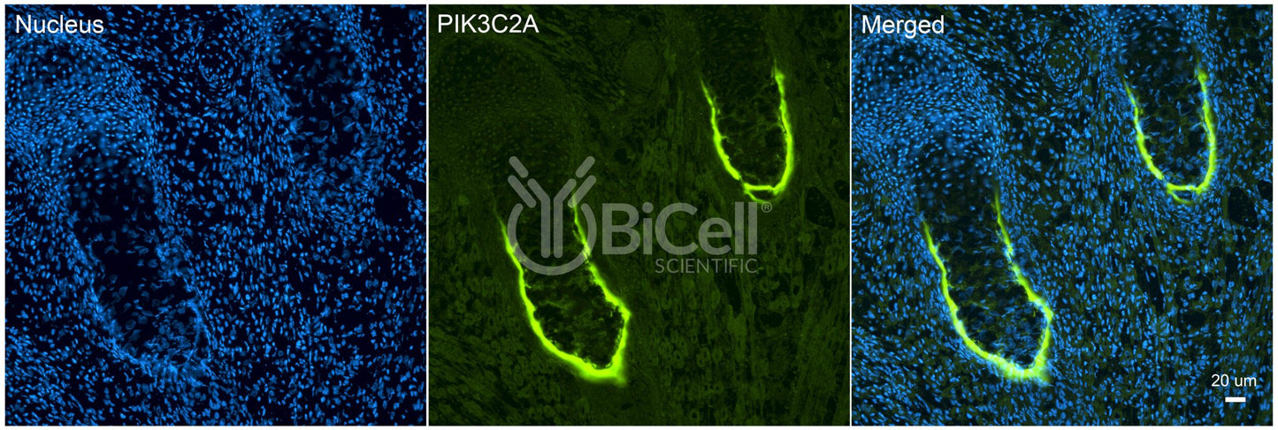 PIK3C2A (PI3K-C2-alpha or PI3-K-C2A) Antibody - FFPE Validated