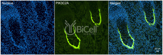 PIK3C2A (PI3K-C2-alpha or PI3-K-C2A) Antibody - FFPE Validated