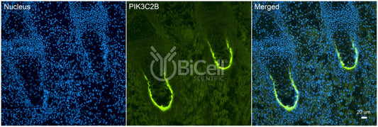 PIK3C2B (C2-PI3K) Antibody - Western Blot Validated