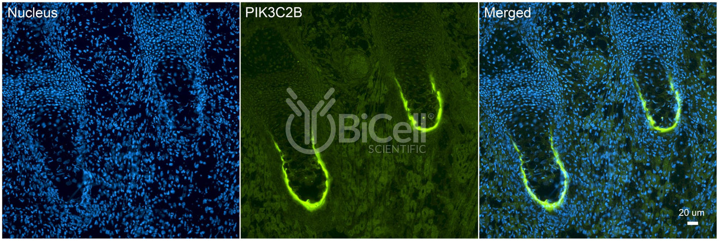 PIK3C2B (C2-PI3K) Antibody - FFPE Validated