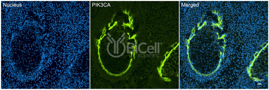 PIK3CA (PI3K-alpha or p110-alpha) Antibody - Western Blot Validated