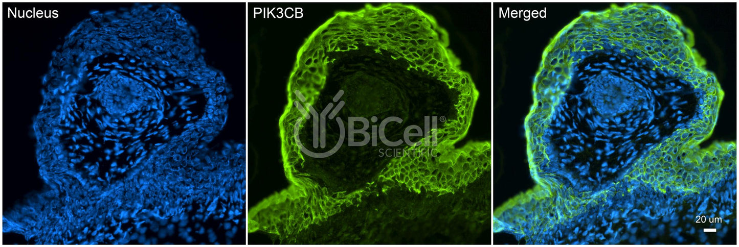 PIK3CB (PI3K-beta or p110-beta) Antibody