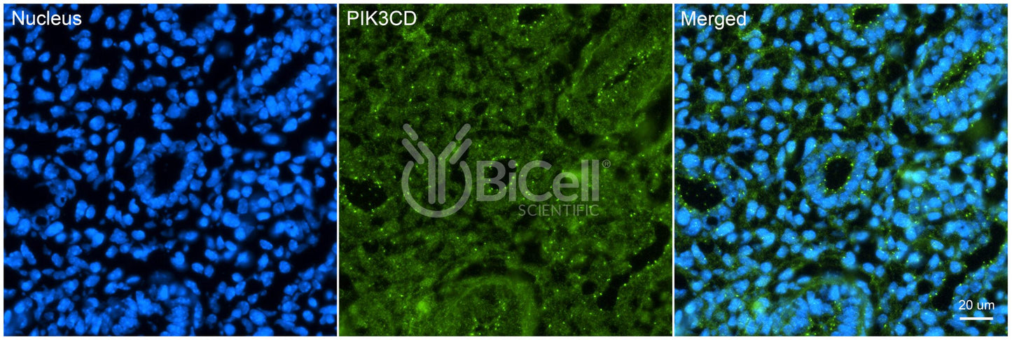 PIK3CD (P110DELTA or p110D) Antibody - FFPE Validated