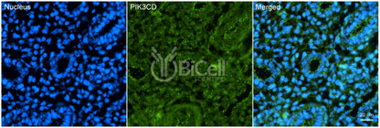 PIK3CD (P110DELTA or p110D) Antibody - FFPE Validated