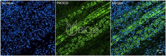 PIK3CD (P110DELTA or p110D) Antibody - Western Blot Validated
