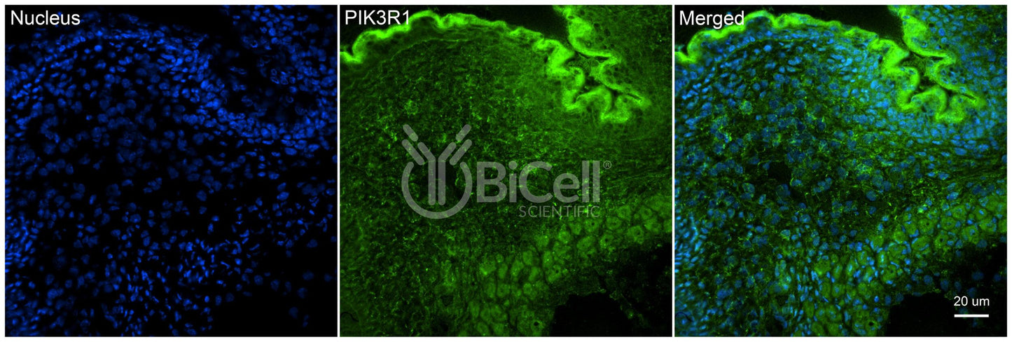 PIK3R1 (p85 or p85alpha) Antibody - Western Blot Validated