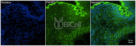 PIK3R1 (p85 or p85alpha) Antibody