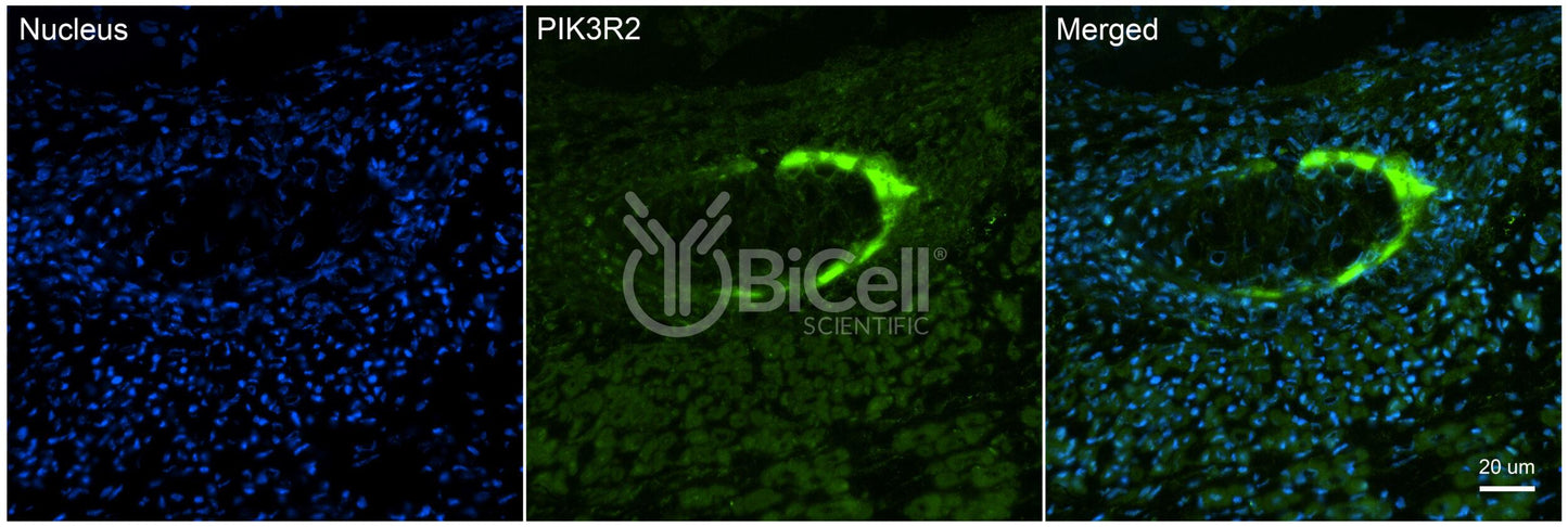 PIK3R2 (p85 or p85beta) Antibody - Western Blot Validated