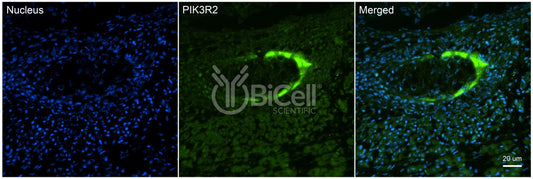 PIK3R2 (p85 or p85beta) Antibody - FFPE Validated
