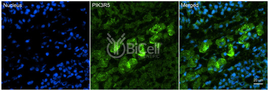 PIK3R5 (p101) Antibody - Western Blot Validated