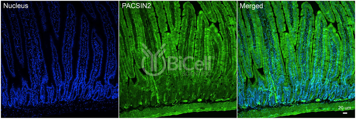 PACSIN2 (SDPII) Antibody
