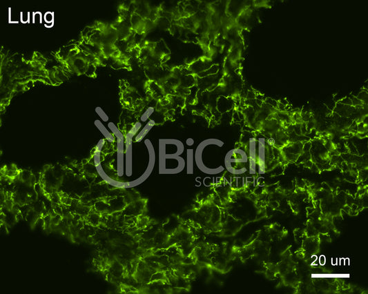 PALS1 (MPP5) Antibody - FFPE Validated